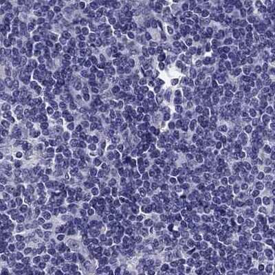 Immunohistochemistry-Paraffin: Secretogranin V Antibody [NBP2-68983] - Staining of human lymph node.