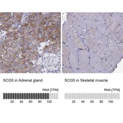 Immunohistochemistry-Paraffin: Secretogranin V Antibody [NBP2-68983] - Analysis in human adrenal gland and skeletal muscle tissues using NBP2-68983 antibody. Corresponding Secretogranin V RNA-seq data are presented for the same tissues.