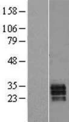 Western Blot: Secretogranin V Overexpression Lysate (Adult Normal) [NBL1-15731] Left-Empty vector transfected control cell lysate (HEK293 cell lysate); Right -Over-expression Lysate for Secretogranin V.