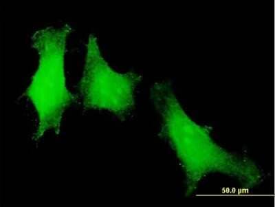 Immunocytochemistry/Immunofluorescence: Securin Antibody [H00009232-B02P] - Analysis of purified antibody to PTTG1 on HeLa cell. (antibody concentration 10 ug/ml)