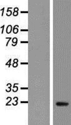 Western Blot PTTG1 Overexpression Lysate