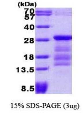 SDS-PAGE Recombinant Human PTTG1 His Protein