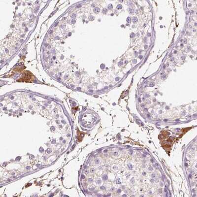 Immunohistochemistry: Seladin 1 Antibody [NBP2-68594] - Immunohistochemical staining of human testis shows cytoplasmic positivity in Leydig cells.