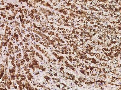 Immunohistochemistry-Paraffin: Seladin 1 Antibody [NBP2-98505] - Immunochemical staining of human Seladin 1 in human adrenal gland with rabbit polyclonal antibody at 1:500 dilution, formalin-fixed paraffin embedded sections.