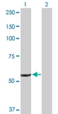 Western Blot: Seladin 1 Antibody [H00001718-D01P] - Analysis of DHCR24 expression in transfected 293T cell line by DHCR24 polyclonal antibody.Lane 1: DHCR24 transfected lysate(60.10 KDa).Lane 2: Non-transfected lysate.