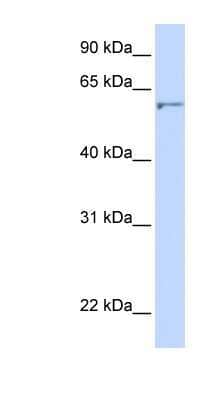 Western Blot: Seladin 1 Antibody [NBP1-59369] - 721_B cell lysate, concentration 0.2-1 ug/ml.