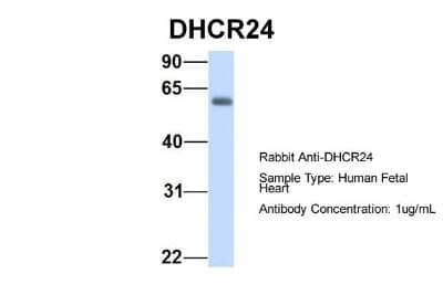 Western Blot: Seladin 1 Antibody [NBP1-59369] - Human Fetal Heart, Antibody Dilution: 1.0 ug/ml.