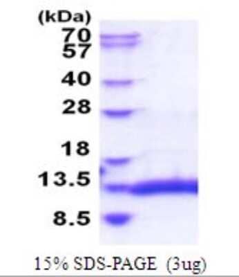 SDS-Page: Selenoprotein W Recombinant Protein [NBP2-51825] - 15% SDS Page (3 ug)