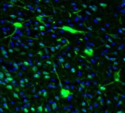 Immunohistochemistry: Semaphorin 3E Antibody [NBP1-84408] - Staining of mouse hypothalamus shows postivity in a subset of neurons in the anterior hypothalamic area.