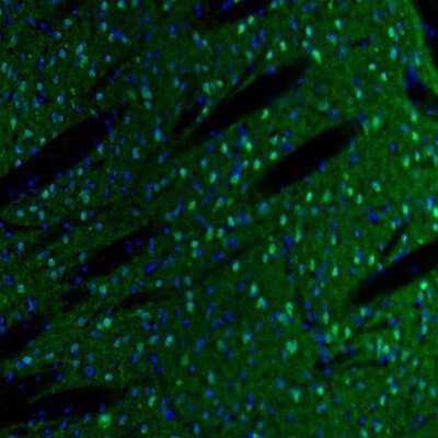 Immunohistochemistry: Semaphorin 3E Antibody [NBP1-84408] - Staining of mouse caudate putamen shows cytoplasmic immunoreactivity in neurons.