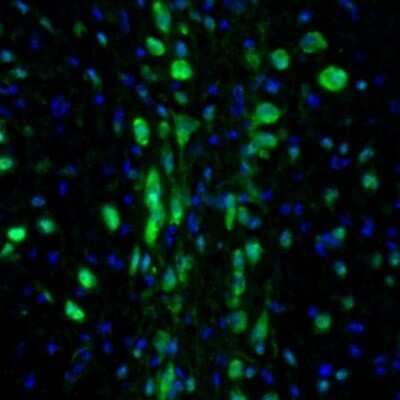 Immunohistochemistry: Semaphorin 3E Antibody [NBP1-84408] - Staining of mouse midbrain shows strong immunoreactivity in the dorsal raphe neurons.