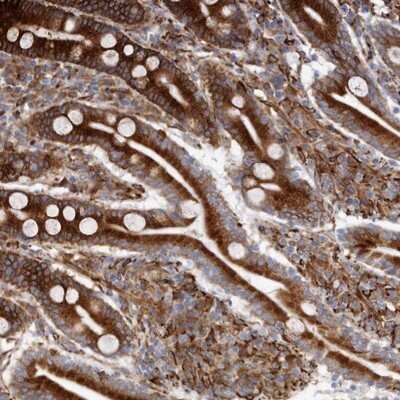 Immunohistochemistry-Paraffin: Semaphorin 3E Antibody [NBP1-84408] - Staining of human duodenum shows strong cytoplasmic positivity in glandular cells.