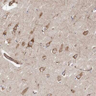Immunohistochemistry-Paraffin: Semaphorin 3E Antibody [NBP1-84408] - Staining of human hippocampus shows positivity in blood vessels and neurons.