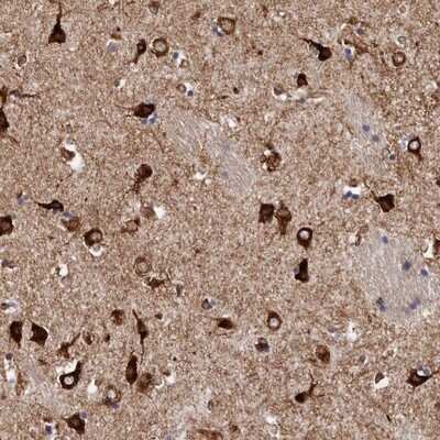 Immunohistochemistry-Paraffin: Semaphorin 3E Antibody [NBP1-84408] - Staining of human lateral ventricle shows strong cytoplasmic positivity in neurons.