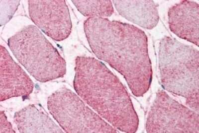 Immunohistochemistry-Paraffin: Semaphorin 4B Antibody [NBP1-78441] - Analysis of anti-SEMA4B antibody with human skeletal muscle.