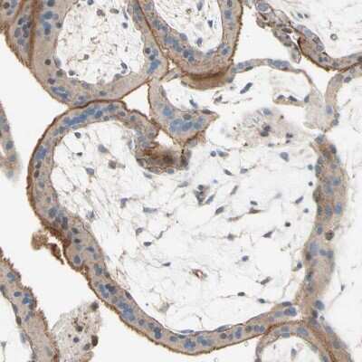 Immunohistochemistry-Paraffin: Semaphorin 4C Antibody [NBP1-80769] - Staining of human placenta shows moderate cytoplasmic positivity in trophoblastic cells.