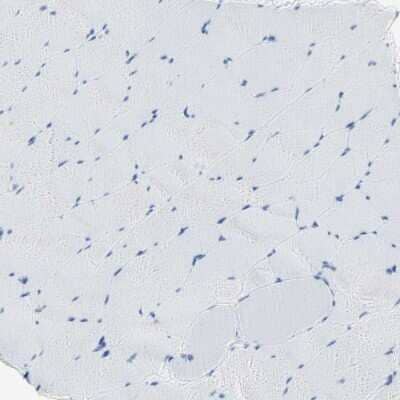 Immunohistochemistry-Paraffin: Semaphorin 4C Antibody [NBP1-80769] - Staining of human skeletal muscle shows no positivity in myocytes as expected.