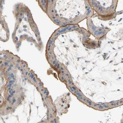 Immunohistochemistry-Paraffin: Semaphorin 4C Antibody [NBP1-80769] - Staining of human placenta shows moderate membranous positivity in trophoblastic cells.