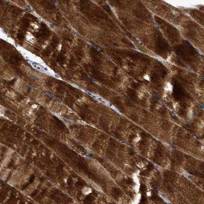 Immunohistochemistry: Semaphorin 4D/CD100 Antibody [NBP1-86704] - Staining of human skeletal muscle shows strong cytoplasmic positivity in myocytes.