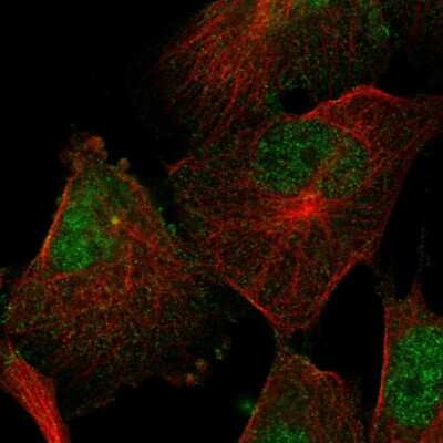 Immunocytochemistry/ Immunofluorescence Semaphorin 4F Antibody - BSA Free