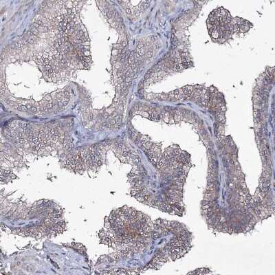 Immunohistochemistry-Paraffin: Semaphorin 4G Antibody [NBP1-82171] - Staining of human prostate shows weak membranous positivity in glandular cells.