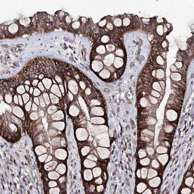 Immunohistochemistry-Paraffin: Semaphorin 4G Antibody [NBP1-82171] - Staining of human rectum shows strong membranous /cytoplasmic positivity in glandular cells.