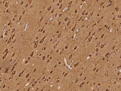 Immunohistochemistry-Paraffin: Semaphorin 4G Antibody [NBP2-97839] - Immunochemical staining of human Semaphorin 4G in human brain with rabbit polyclonal antibody at 1:100 dilution, formalin-fixed paraffin embedded sections.