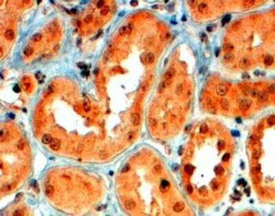 Immunohistochemistry-Paraffin Semaphorin 5A Antibody