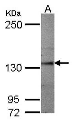 Western Blot: Semaphorin 5A Antibody [NBP2-20290] -  Sample (50 ug of whole cell lysate) A: Mouse Brain, 5% SDS PAGE gel, diluted at 1:1000.