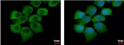 Immunocytochemistry/Immunofluorescence: Semaphorin 6A Antibody [NBP1-31551] - [N2C1], Internal detects SEMA6A protein at cytoplasm by immunofluorescent analysis. Sample: A431 cells were fixed in 4% paraformaldehyde at RT for 15 min.Green: SEMA6A protein stained by SEMA6A antibody [N2C1], Diluted at 1:500.Blue: Hoechst 33342 staining.