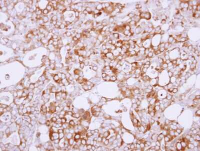 Immunohistochemistry-Paraffin: Semaphorin 6A Antibody [NBP1-31551] - Paraffin-embedded NCI-N87 xenograft, using antibody at 1:100 dilution.