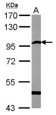 Western Blot: Semaphorin 6A Antibody [NBP1-31551] - Sample (50 ug of whole cell lysate) A: Mouse brain 7. 5% SDS PAGE; antibody diluted at 1:1000.