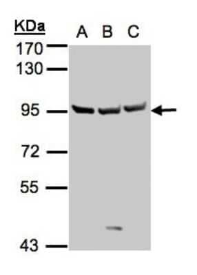 Western Blot: Semaphorin 6A Antibody [NBP1-31551] - Sample(30 ug whole cell lysate) A:A431 B:Hep G2 7.5% SDS PAGE, antibody diluted at 1:1000.