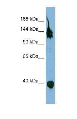 Western Blot: Semaphorin 6A Antibody [NBP1-69281] - This Anti-Semaphorin 6A  antibody was used in Western Blot of OVCAR-3   tissue lysate at a concentration of 1ug/ml.