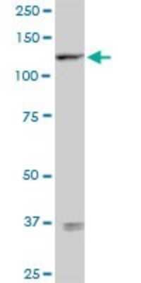 Western Blot: Semaphorin 6D Antibody [H00080031-D01P] - Analysis of SEMA6D expression in Jurkat.