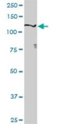Western Blot: Semaphorin 6D Antibody [H00080031-D01P] - Analysis of SEMA6D expression in mouse lung.