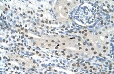 Immunohistochemistry: Semenogelin I Antibody [NBP1-58013] - Paraffin Embedded Tissue: Human Kidney Cellular Data: Epithelial cells of renal tubule Antibody Concentration: 4.0 - 8.0 ug/ml Magnification: 400X