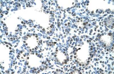 Immunohistochemistry: Semenogelin I Antibody [NBP1-58013] - Paraffin Embedded Tissue: Human Lung Cellular Data: Alveolar cells Antibody Concentration: 4.0 - 8.0 ug/ml Magnification: 400X