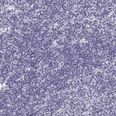 Immunohistochemistry-Paraffin: Semenogelin I Antibody [NBP1-85425] - Staining of human lymph node shows low expression as expected.