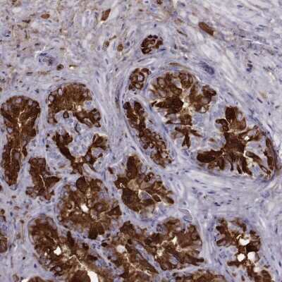 Immunohistochemistry-Paraffin: Semenogelin I Antibody [NBP1-85425] - Staining of human seminal vesicle shows high expression.