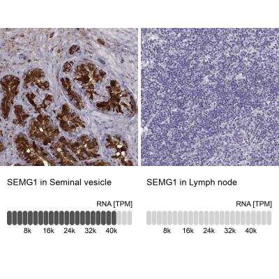 <b>Orthogonal Strategies Validation. </b>Immunohistochemistry-Paraffin: Semenogelin I Antibody [NBP1-85425] - Staining in human seminal vesicle and lymph node tissues using anti-SEMG1 antibody. Corresponding SEMG1 RNA-seq data are presented for the same tissues.