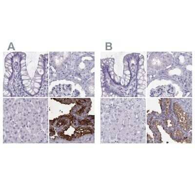 <b>Independent Antibodies Validation. </b>Immunohistochemistry-Paraffin: Semenogelin I Antibody [NBP1-85425] - Staining of human colon, kidney, liver and seminal vesicle using Anti-SEMG1 antibody NBP1-85425 (A) shows similar protein distribution across tissues to independent antibody NBP2-62646 (B).