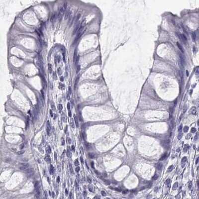 Immunohistochemistry-Paraffin: Semenogelin I Antibody [NBP1-85425] - Staining of human colon.