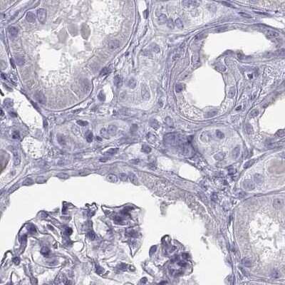 Immunohistochemistry-Paraffin: Semenogelin I Antibody [NBP1-85425] - Staining of human kidney.