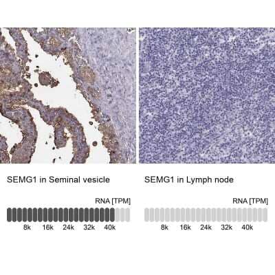 <b>Orthogonal Strategies Validation. </b>Immunohistochemistry-Paraffin: Semenogelin I Antibody [NBP2-62646] - Immunohistochemistry analysis in human seminal vesicle and lymph node tissues using Anti-SEMG1 antibody. Corresponding SEMG1 RNA-seq data are presented for the same tissues.