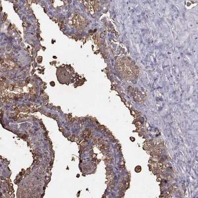 Immunohistochemistry-Paraffin: Semenogelin I Antibody [NBP2-62646] - Staining of human seminal vesicle shows high expression.