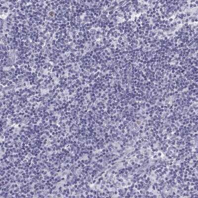 Immunohistochemistry-Paraffin: Semenogelin I Antibody [NBP2-62646] - Staining of human lymph node shows low expression as expected.