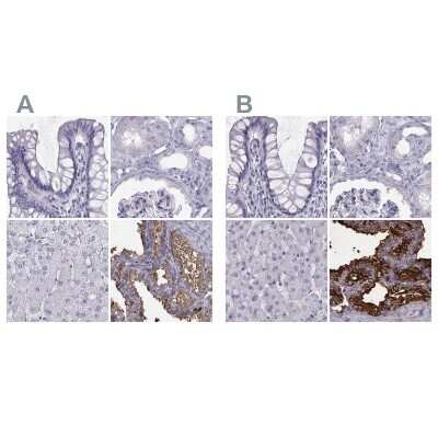 <b>Independent Antibodies Validation. </b>Immunohistochemistry-Paraffin: Semenogelin I Antibody [NBP2-62646] - Staining of human colon, kidney, liver and seminal vesicle using Anti-SEMG1 antibody NBP2-62646 (A) shows similar protein distribution across tissues to independent antibody NBP1-85425 (B).