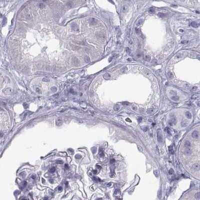 Immunohistochemistry-Paraffin: Semenogelin I Antibody [NBP2-62646] - Staining of human kidney.