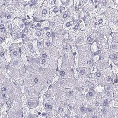 Immunohistochemistry-Paraffin: Semenogelin I Antibody [NBP2-62646] - Staining of human liver.